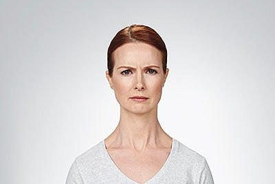 Cheek Fillerzz Before & After